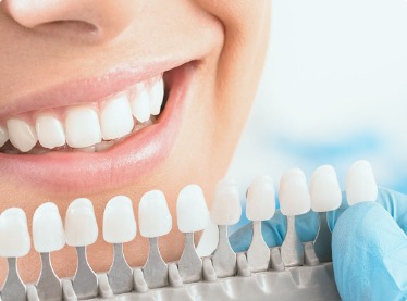 歯科提携・医療系セルフホワイトニングの特徴